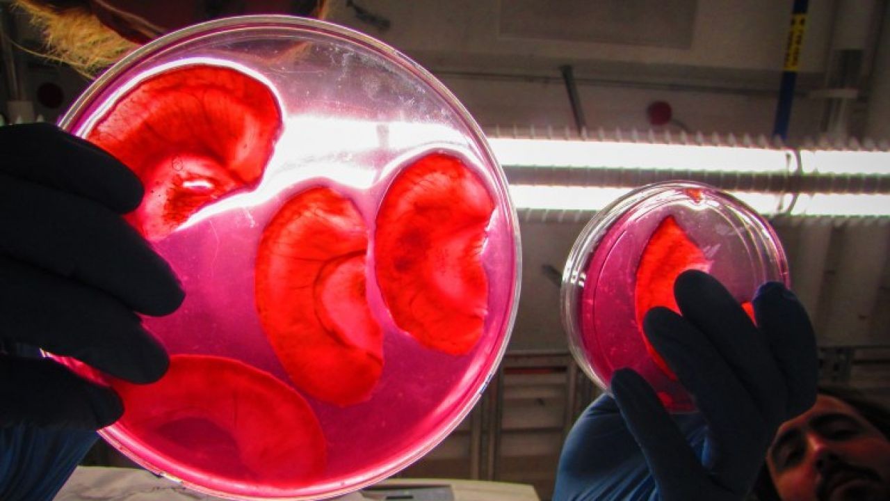 Tutkijat ovat tehneet vaikuttavan läpimurron regeneratiivisessa lääketieteessä: he ovat luoneet keinotekoiset munuaiset.