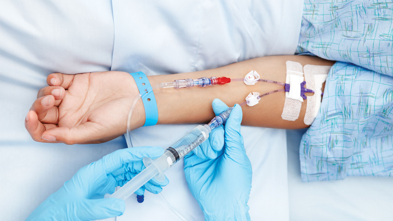 Syövän ihonalainen immunoterapia: mikä se on ja miksi se muuttaa syövän hoitomenetelmiä.