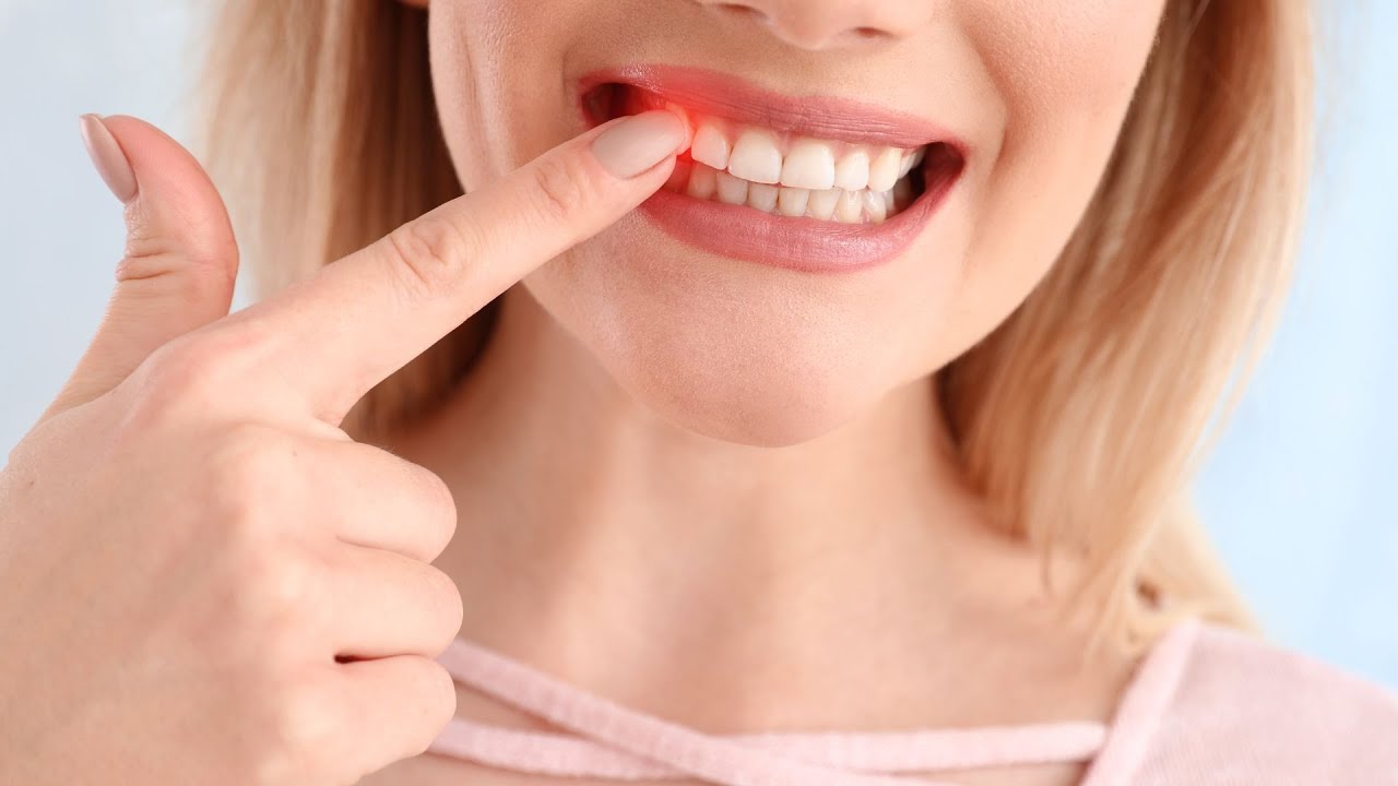 Miksi ikenien hoito on tärkeää sydämen terveydelle